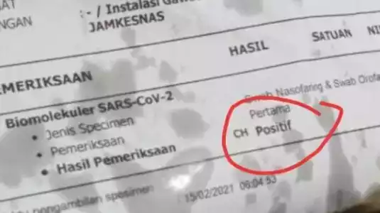 Siswa Positif COVID-19 di Kota Jogja Bertambah Lagi