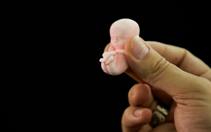 Pengadilan India Kabulkan Permohonan Aborsi Bocah 10 Tahun