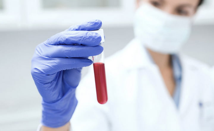 Ilmuwan Kembangkan Metode Tes Darah untuk Deteksi Kanker