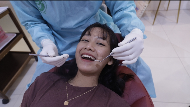 Bedanya Bleaching dan Veneer: Mana yang Lebih Cocok untuk Anda?