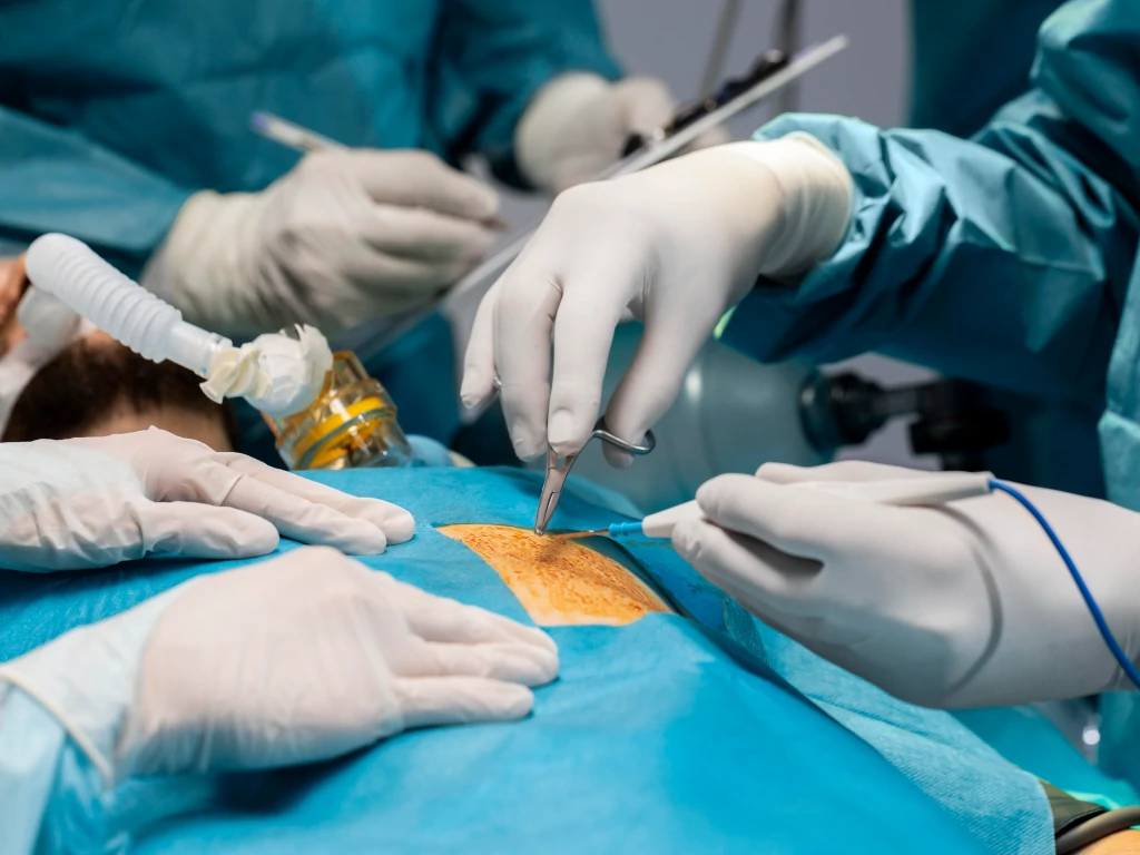 Sekilas Mengenai Transplantasi Ginjal di Indonesia